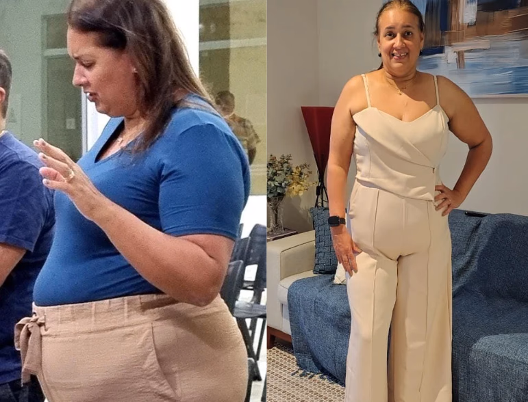 Cristiane — antes e depois com o Protocolo 5D