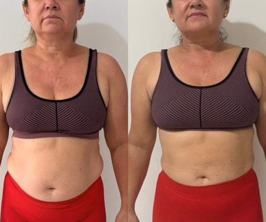 Vitória — antes e depois com o Protocolo 5D